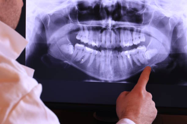 Best Emergency Broken Tooth Repair in Buchanan, NY