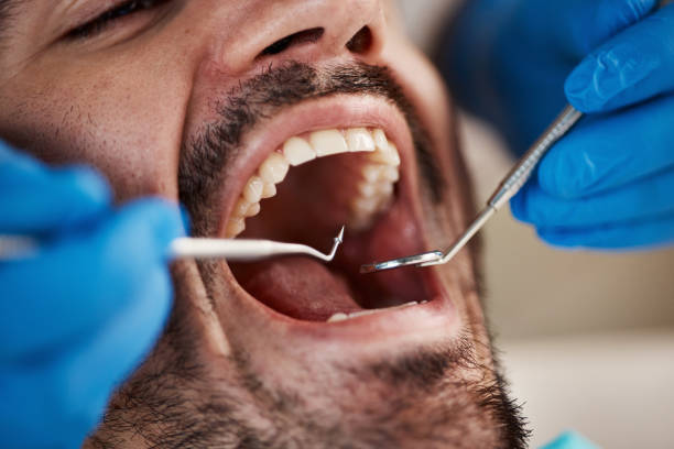 Best Emergency Tooth Extraction in Buchanan, NY