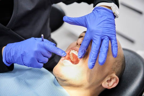 Best Emergency Broken Tooth Repair in Buchanan, NY